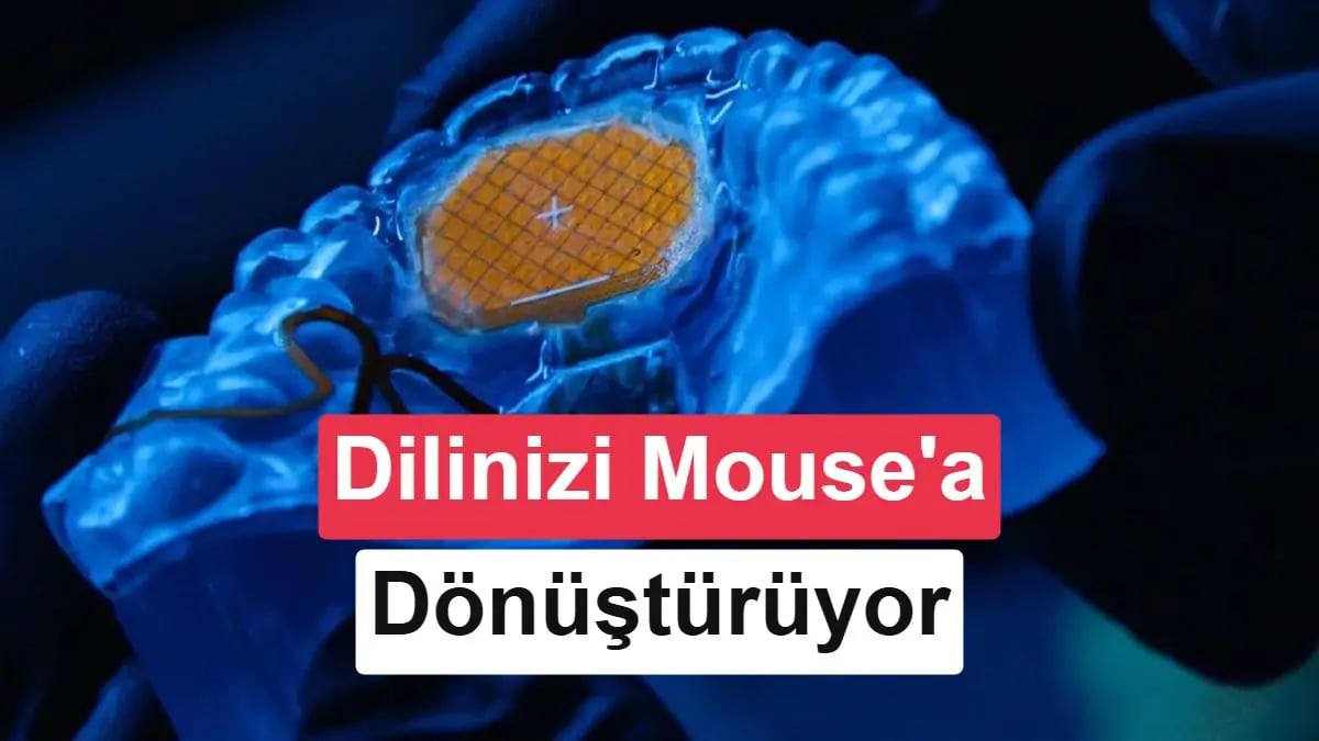 Dil Hareketleriyle Bilgisayar Kontrolü: MouthPad Devrim Başladı