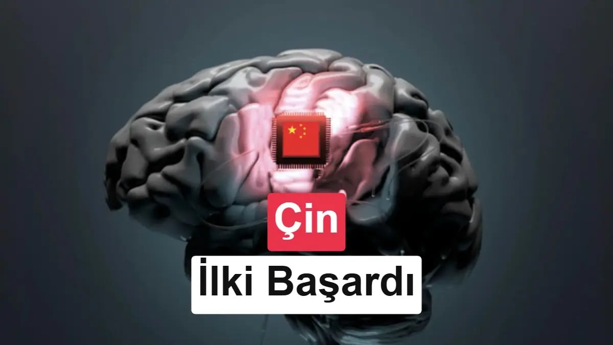 Felç Yasa Çizildi: Beyin Sinirleri Teknolojiyle Yeniden Canlandı