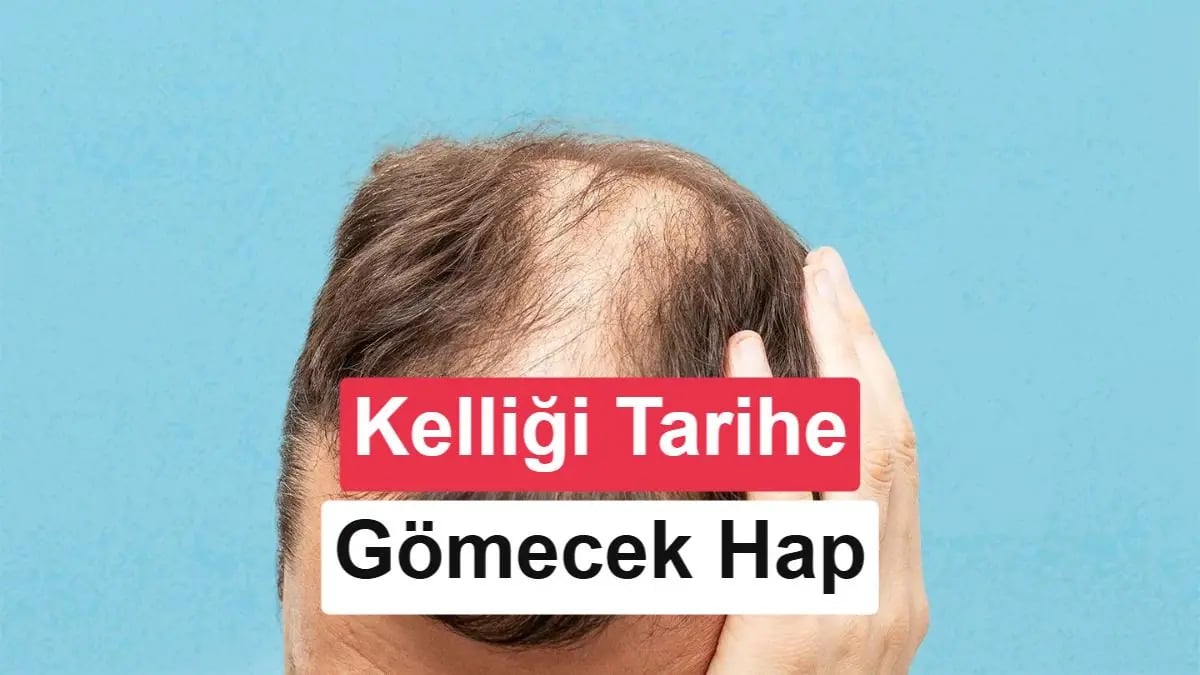 Kalıcı Saç Çözümü: Kellik Tedavisinde Devrim Niteliğinde Yeni Hap