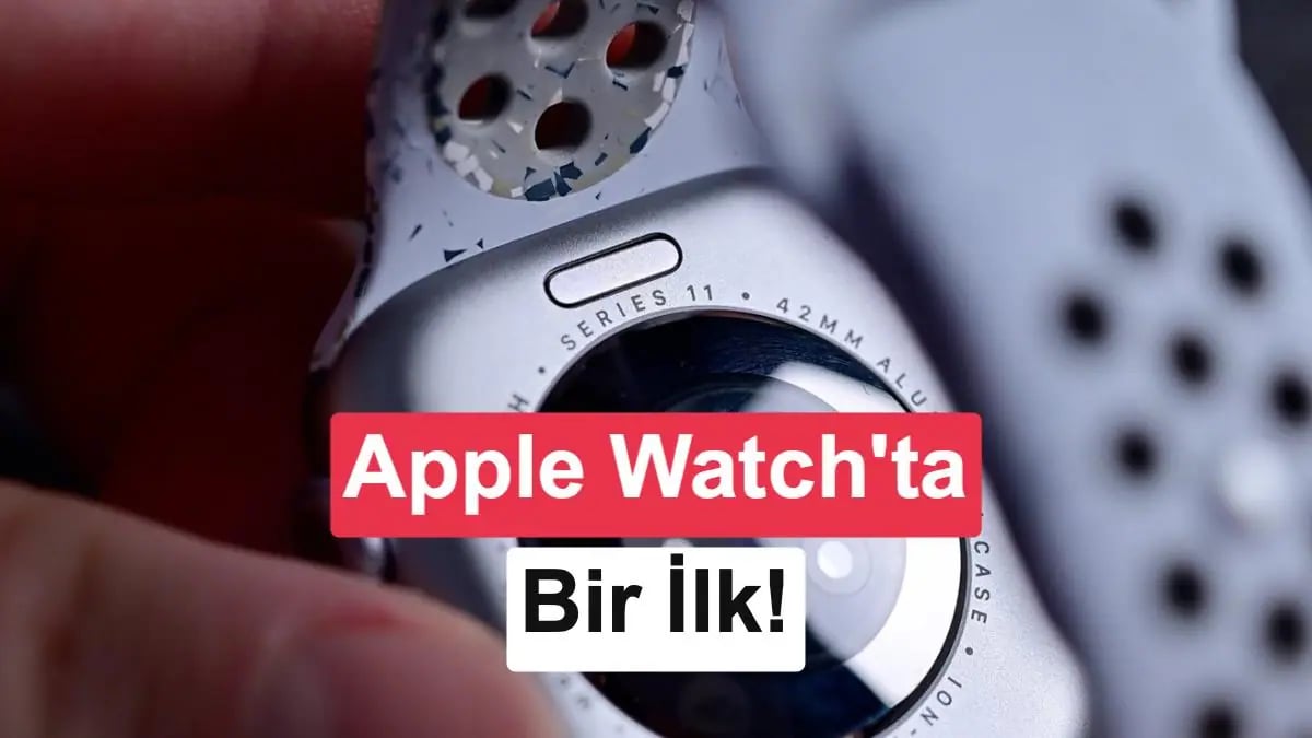 Apple Watch'ta Dev Sağlık Hamlesi: Sensör Kayışa Entegre Ediliyor