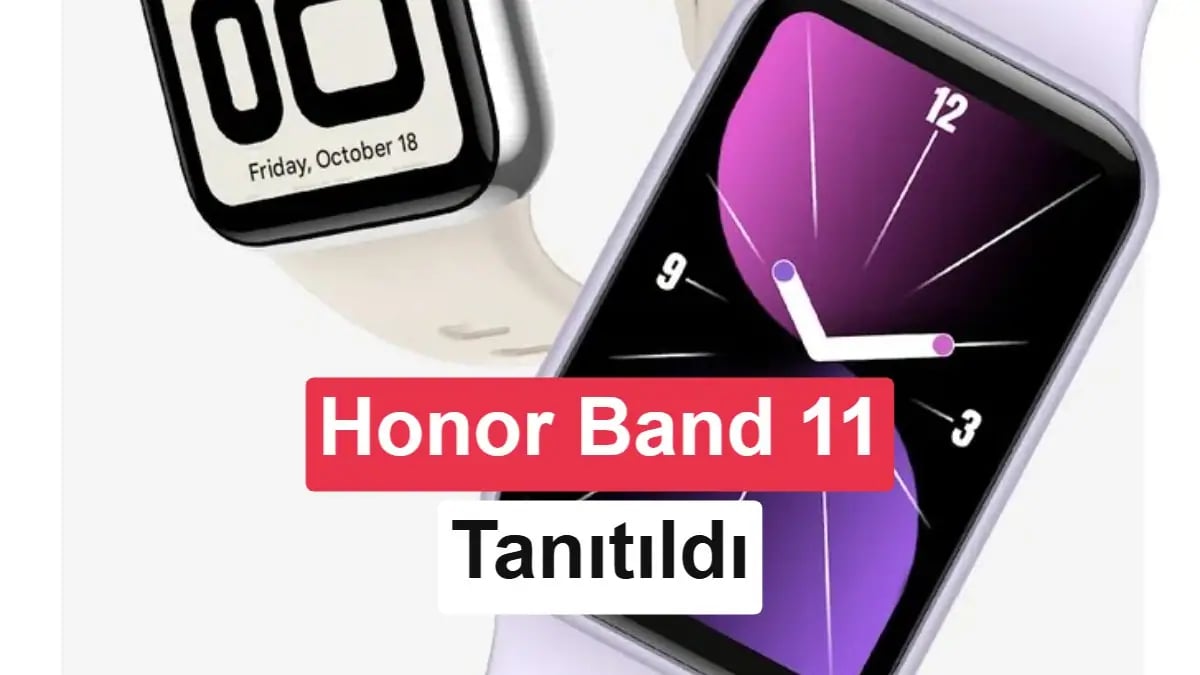Honor Band 11 ile Akıllı Bileklik Sınırları Zorlanıyor