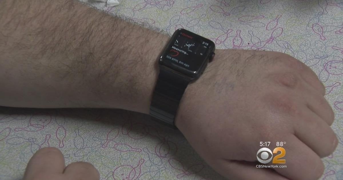 iPhone Sahibi Canı Kurtaran Akıllı Saat: Apple Watch Hayati Bir Durumda Teslim Oldu